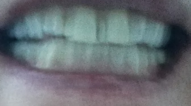 AV min tand…. og pengepung